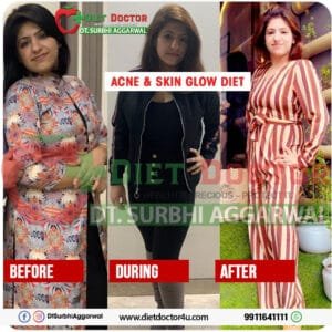 Best Dietician in Delhi