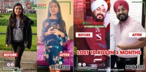 Best Dietician in Delhi