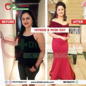 Thyroid PCOD Diet Thyroid PCOD Diet
