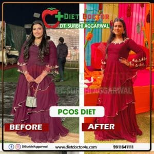 Best Dietician in Delhi