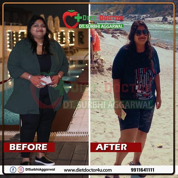 Best Dietician in Delhi