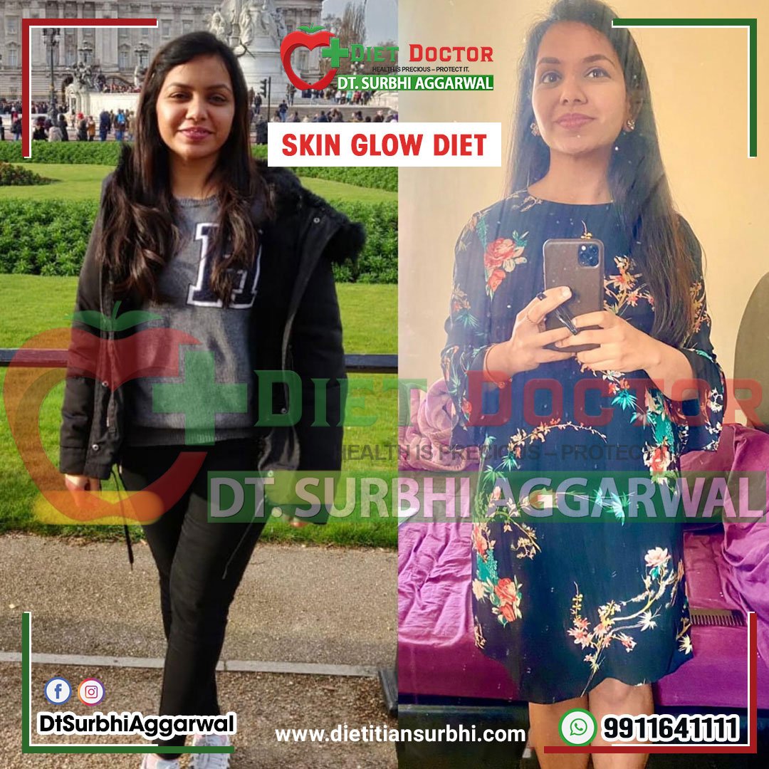 Skin Glow Diet dietitian surbhi transformation, success story