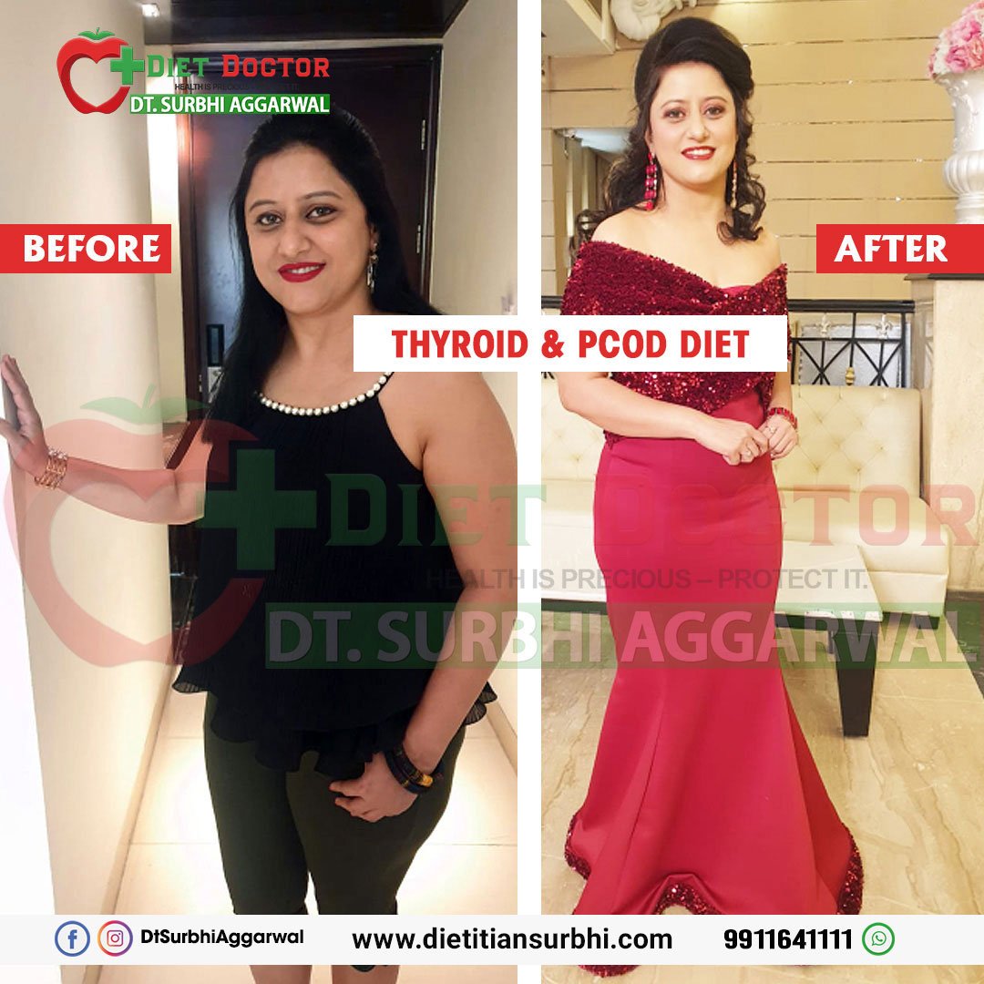 dietitian surbhi transformation