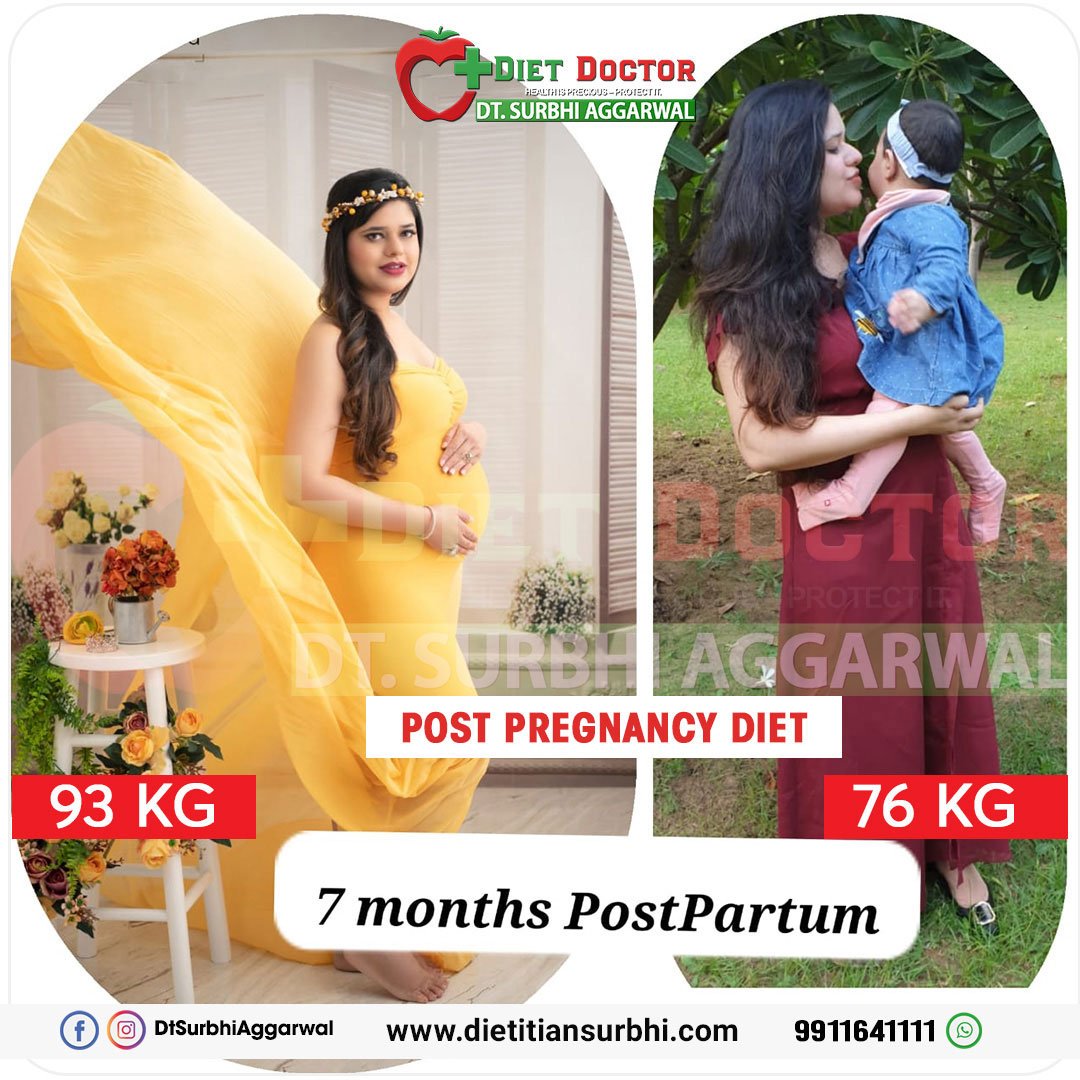 dietitian surbhi transformation, success story. Post Pregnancy Diet